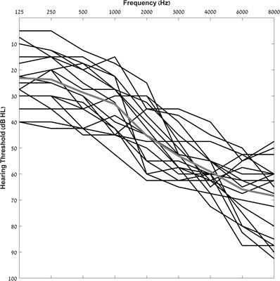 Neural Plasticity Induced by Hearing Aid Use